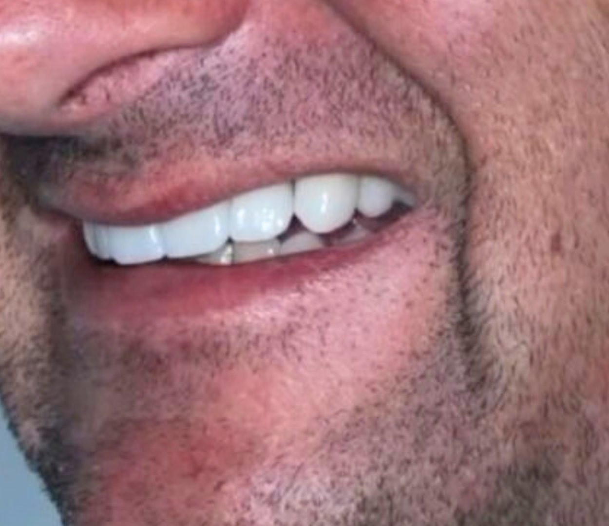 Cópia de Design sem nome